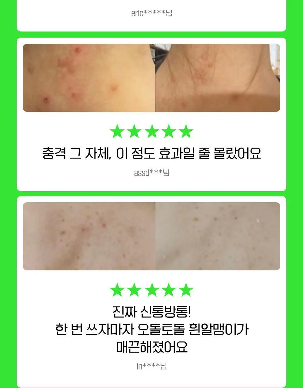 [1위등드름워시/단독기획] 파티온 노스카나인 트러블 바디워시 490ml 기획 상세페이지 8